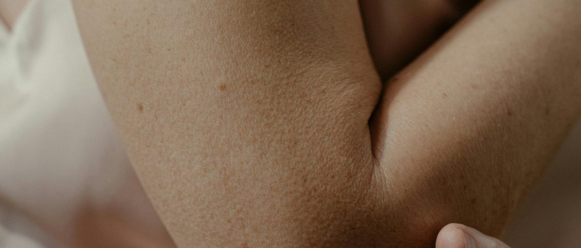 Epicondilite - Clínica de Terapias Naturais